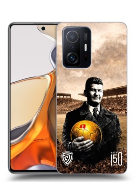Kryt pro Xiaomi 11T Pro s motivem Baťa 150