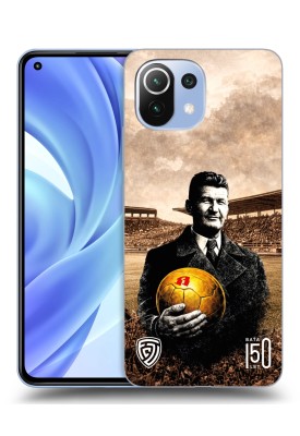 Kryt pro Xiaomi Mi 11 Lite s motivem Baťa 150